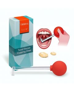 tonsil stones cupping glass tonsil stones removal